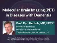 Molecular brain imaging (PET) in diseases with dementia