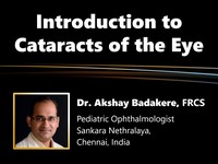 Introduction to cataracts of the eye