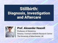 Stillbirth: diagnosis, investigation and aftercare